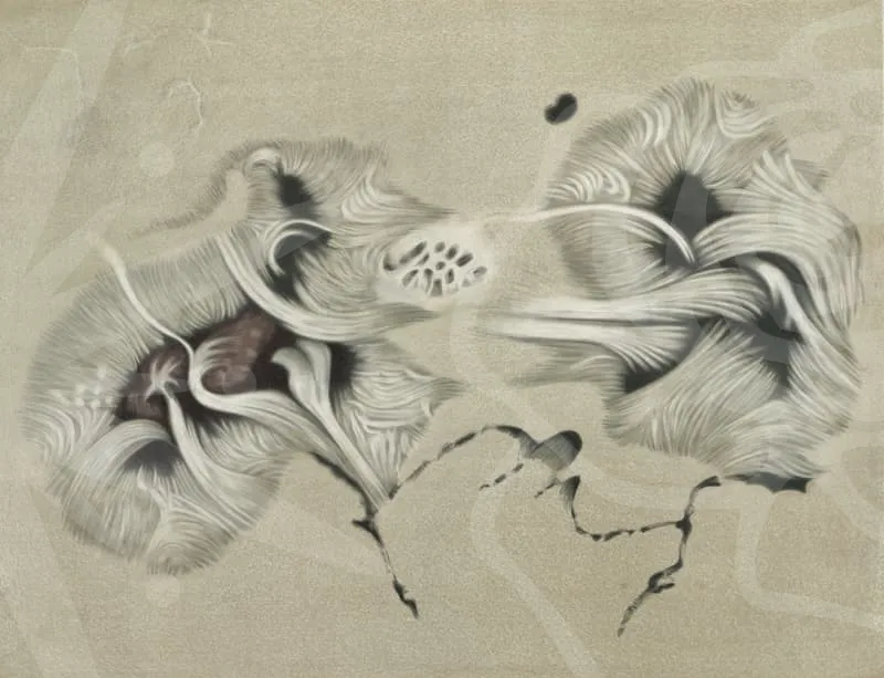 교통사고합의금계산